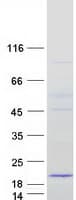 Human MRPS16 Protein (Recombinant Myc-DDK (Flag))