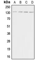 ADCY5+6 Antibody (C-Terminus)