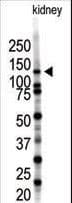 SENP7 Antibody (aa709-740)