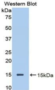 DCN / Decorin Antibody (aa45-152)