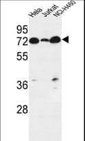 LPPR4 / PRG1 Antibody (aa666-695)
