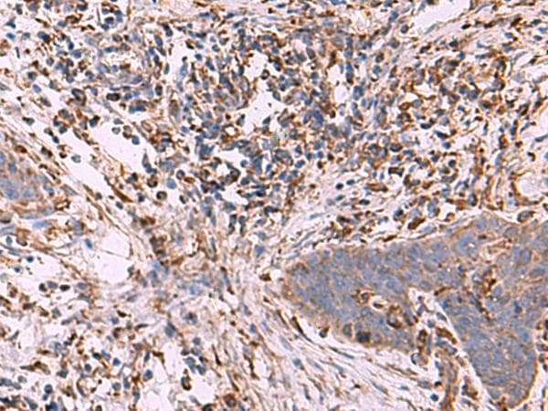 Polyclonal Rabbit anti-Human G6PC / Glucose-6-Phosphatase Antibody (IHC)