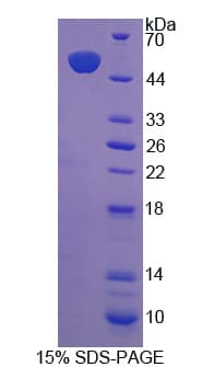 Human COQ10B Protein (Recombinant His-GST)