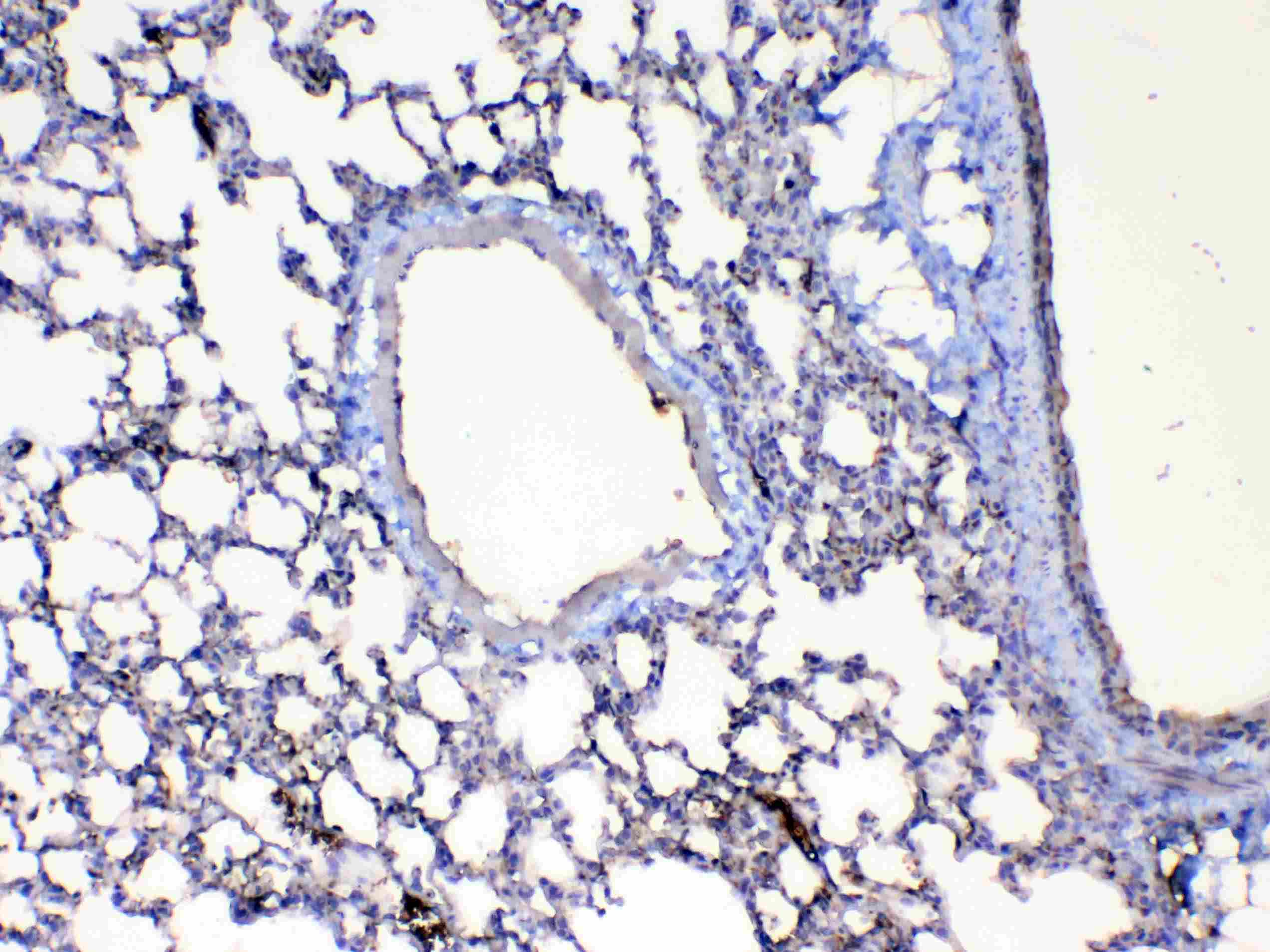 CFD / Factor D / Adipsin Antibody