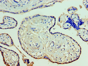 ANXA11 / Annexin XI Antibody (aa276-505)