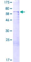Human IIP45 / MIIP Protein (Recombinant GST)