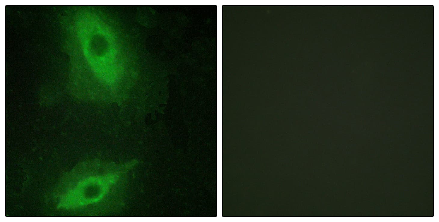 Polyclonal Rabbit anti-Human TNFSF15 / TL1A / VEGI Antibody (aa181-230, IF, WB)