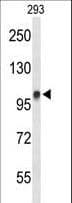 Polyclonal Rabbit anti-Human DDX23 / PRP28 Antibody (aa248-277, IHC, WB)