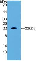 EPO / Erythropoietin Antibody (aa28-192)