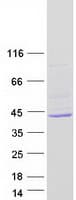 Human ZC3HAV1L Protein (Recombinant Myc-DDK (Flag))