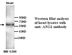 Polyclonal Rabbit anti-Human ANGPT1 / Angiopoietin-1 Antibody (N-Terminus, IHC, WB)
