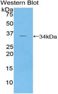GPT / Alanine Transaminase Antibody (aa143-417)