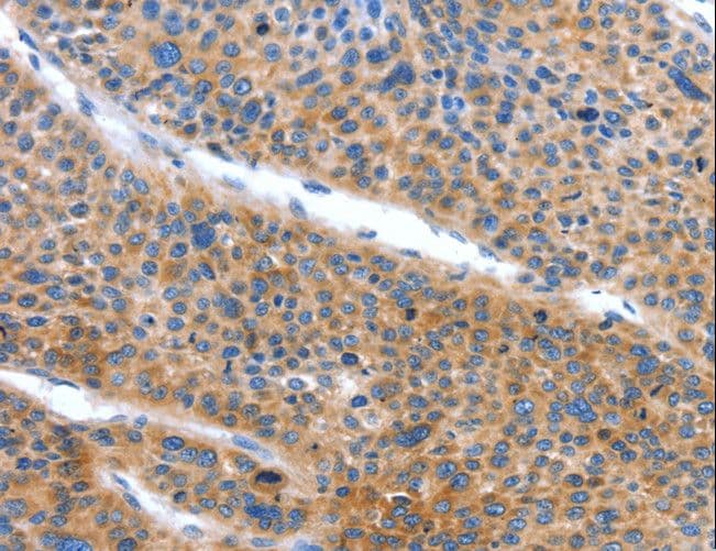 Polyclonal Rabbit anti-Human ARL11 Antibody (IHC)