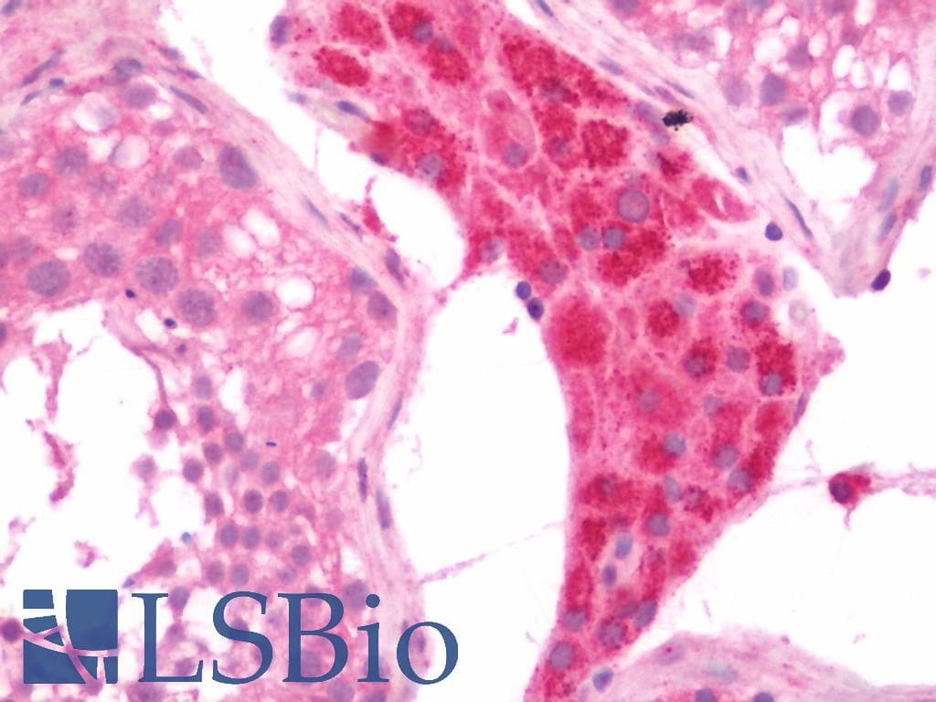 IHC-plus™ CACNA1H / Cav3.2 Antibody