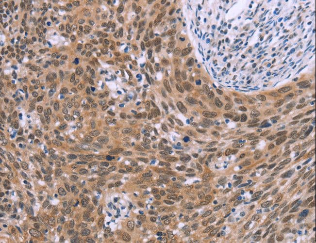 Polyclonal Rabbit anti-Human GLYR1 Antibody (IHC)