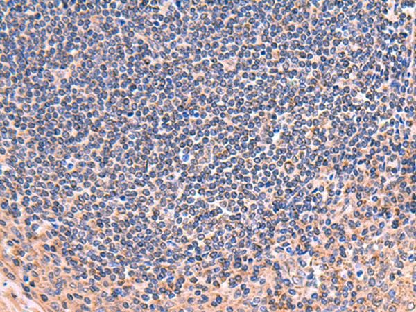 Polyclonal Rabbit anti-Human ZNF256 Antibody (IHC)