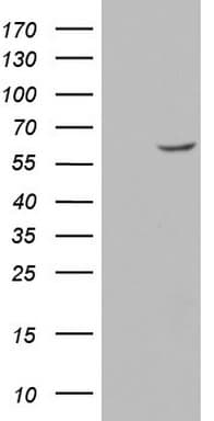 Monoclonal Mouse anti-Human GBA / Glucosidase Beta Acid Antibody (clone OTI1C7, aa40-315, WB)
