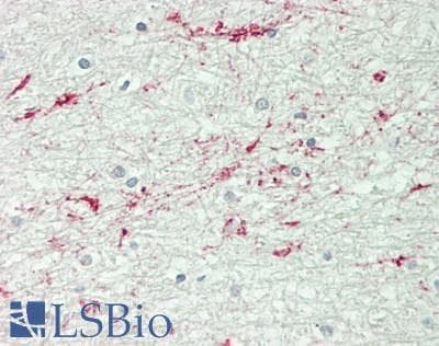 IHC-plus™ RAPGEF2 Antibody (aa975-1025)