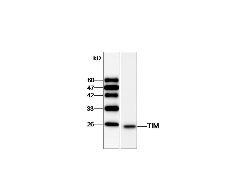 IHC-plus™ Monoclonal Mouse anti-Human TPI1 / TPI Antibody (IHC, WB)