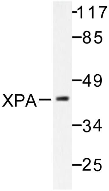 XPA Antibody (His244)