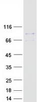 Human EPN3 Protein (Recombinant Myc-DDK (Flag))