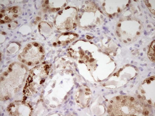 Monoclonal Mouse anti-Human PAPSS2 Antibody (clone OTI2E7, Carrier-free, aa1-247, IHC, WB)
