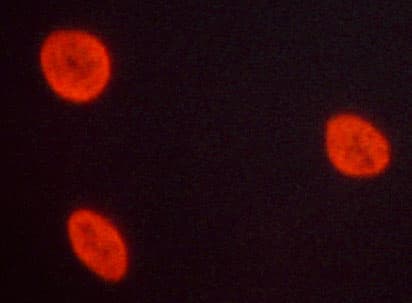 NFKB1 / NF-Kappa-B Antibody