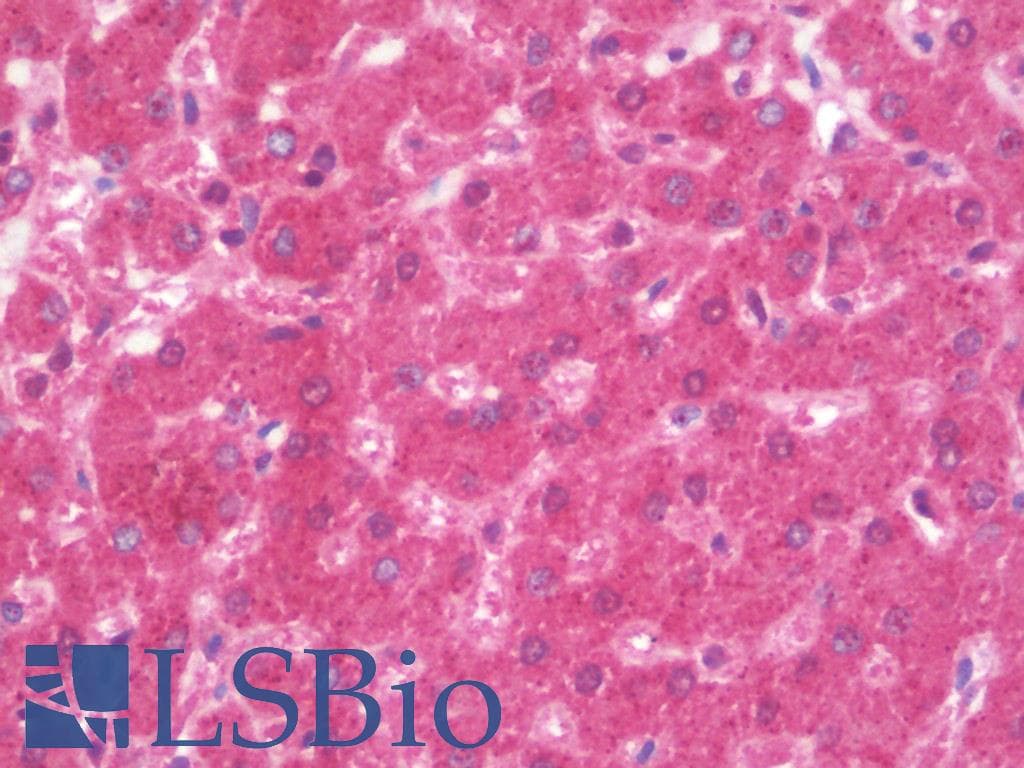 IHC-plus™ RPL12 / Ribosomal Protein L12 Antibody (aa61-110)