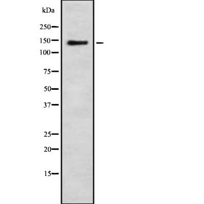 Polyclonal Rabbit anti-Human CEP152 Antibody (WB)