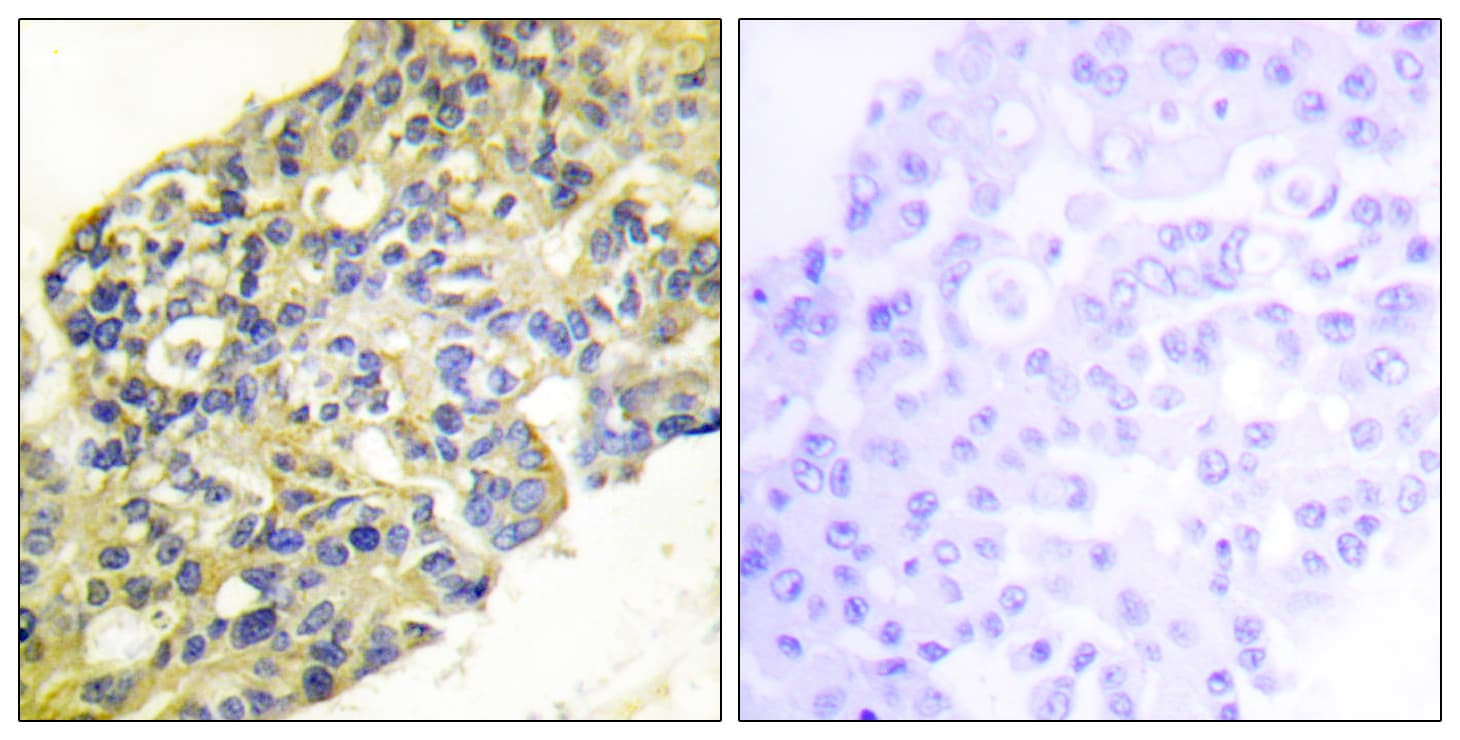 PI3K Alpha+Gamma Antibody (Internal)