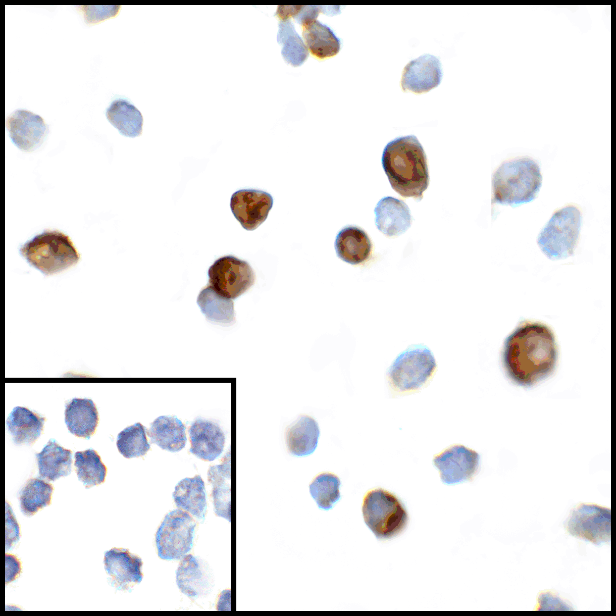 CTLA4 / CD152 Antibody (clone 2G10)