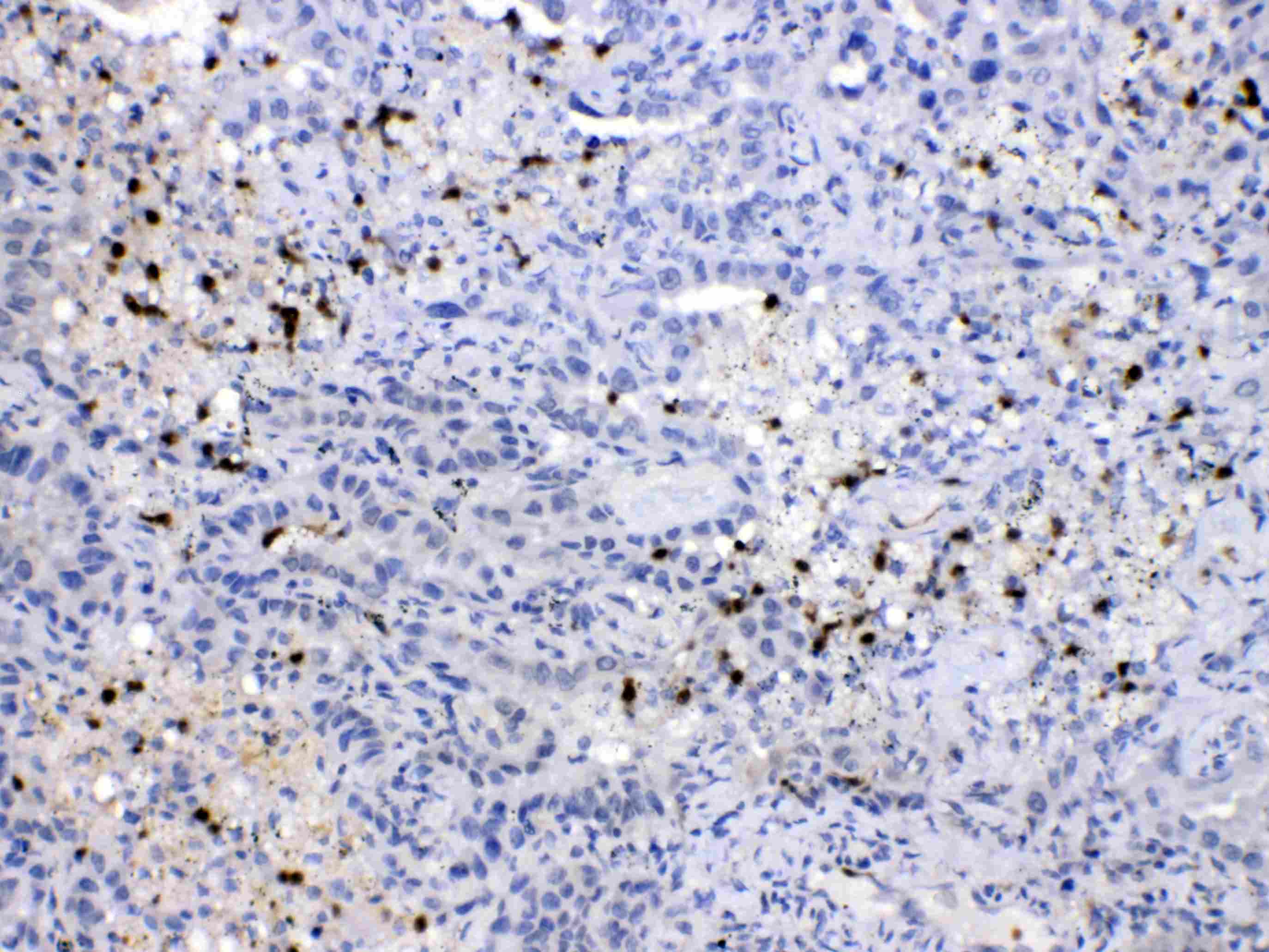 Polyclonal Rabbit anti-Human NEDD8 Antibody (IHC, WB)