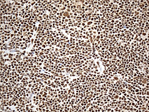DDX39B / UAP56 Antibody (aa319-428, clone OTI2G7)