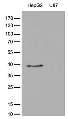 GALM / Mutarotase Antibody (clone OTI7B7)