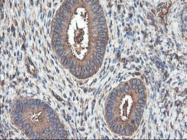 TUBAL3 Antibody (clone OTI4C5)