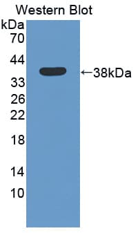 Polyclonal Rabbit anti-Human BCAS3 Antibody (FITC, aa230-546, WB)