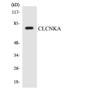 Polyclonal Rabbit anti-Human CLCNKA Antibody (aa567-616, WB)