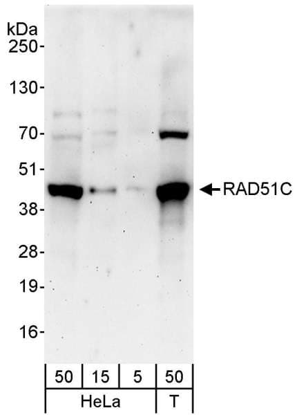RAD51C Antibody (aa326-376)