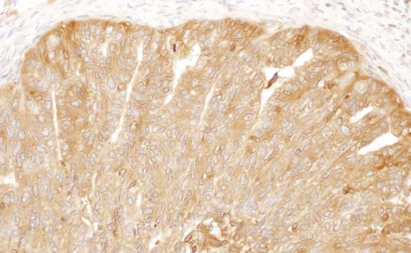 CAP1 Antibody (aa275-325)