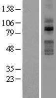 TLK2 Protein (Over-Expression Lysate Myc-DDK (Flag))