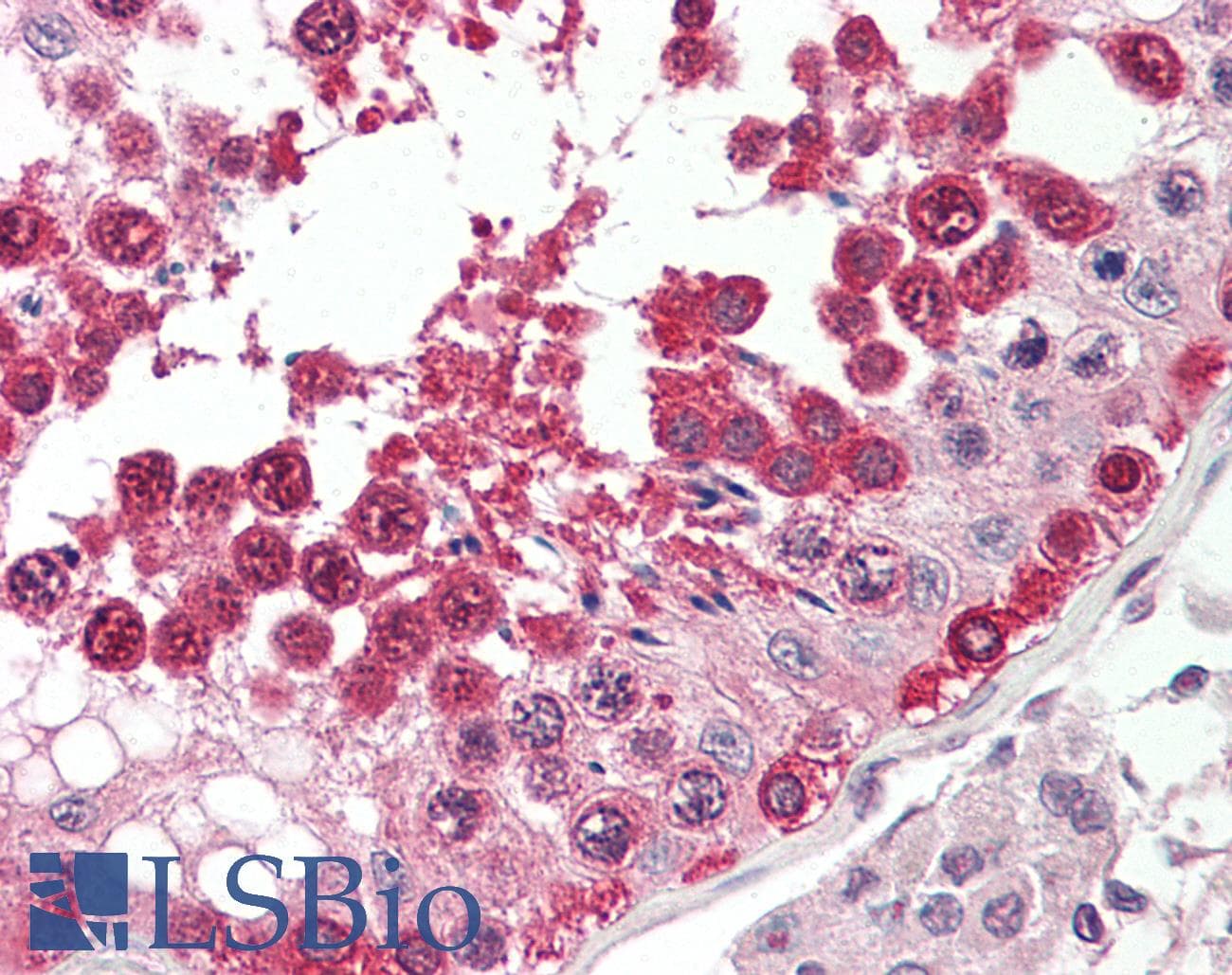 IHC-plus™ TSN / Translin Antibody (aa101-150)