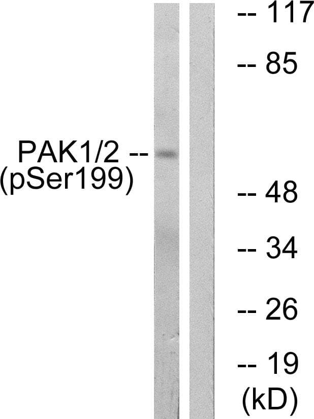PAK1 Antibody (phospho-Ser199)