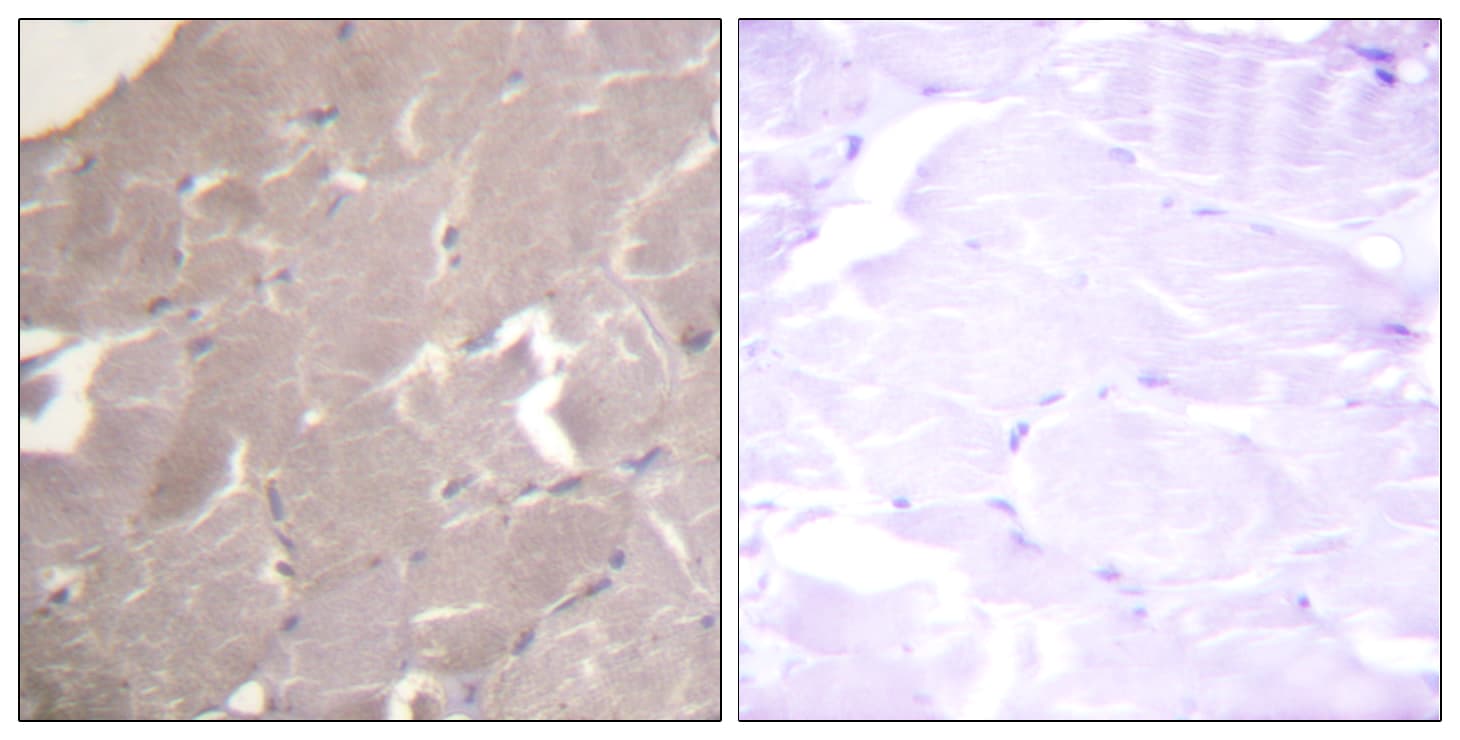 Polyclonal Rabbit anti-Human IKK Alpha+Beta Antibody (Internal, IHC, WB)