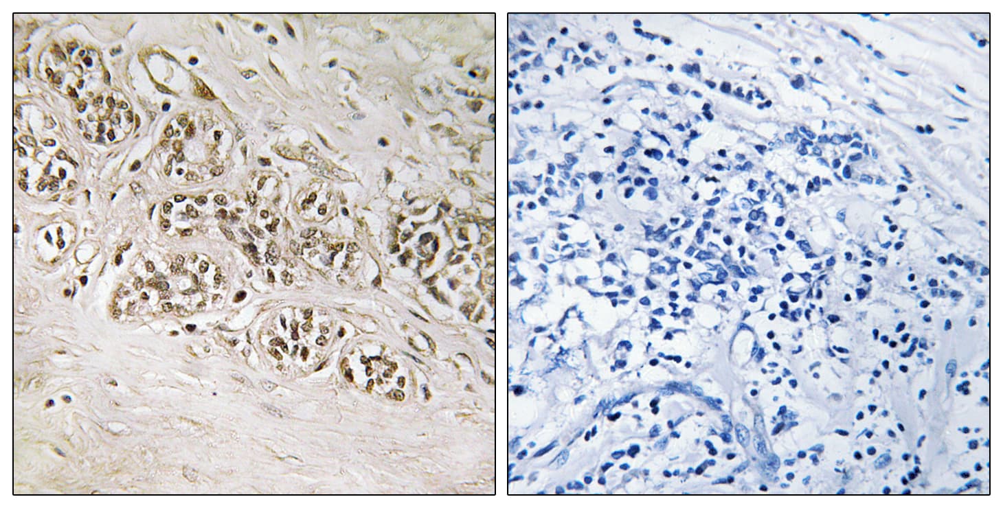 RAD54B Antibody (aa241-290)