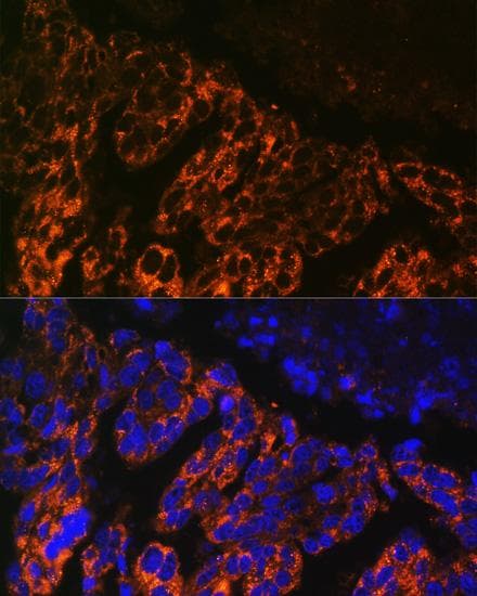 SCNN1A / ENaC Alpha Antibody
