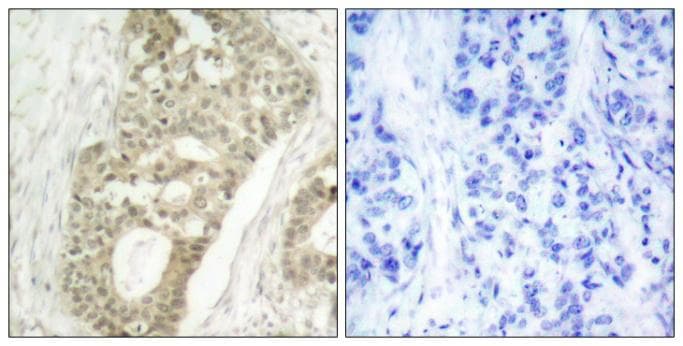 PRKCD / PKC-Delta Antibody (phospho-Ser645)