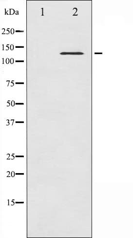 Polyclonal Rabbit anti-Human ABL1 / c-ABL Antibody (phospho-Tyr204, IF, WB)