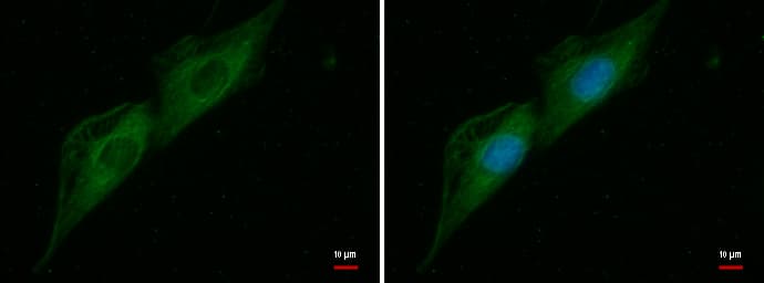 NES / Nestin Antibody (aa1405-1621)