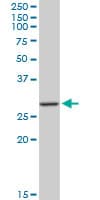 MAGE12 / MAGEA12 Antibody (clone 3A10)