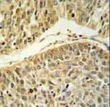 RERE Antibody (aa383-409)